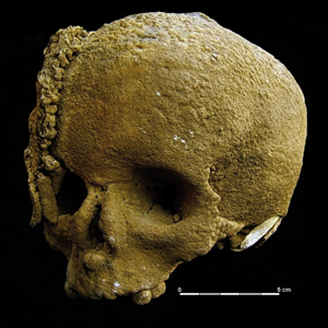 Crâne d’enfant calcifié - site vérazien (-2500 ans) (grotte de Roquemaure - Saint-Amancet)